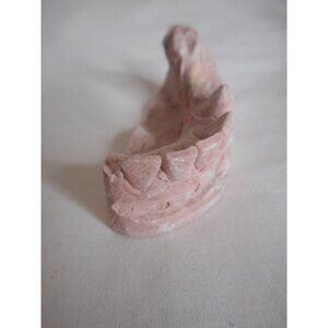Vintage Cast Dental Teeth Mold  Tooth Castings Med